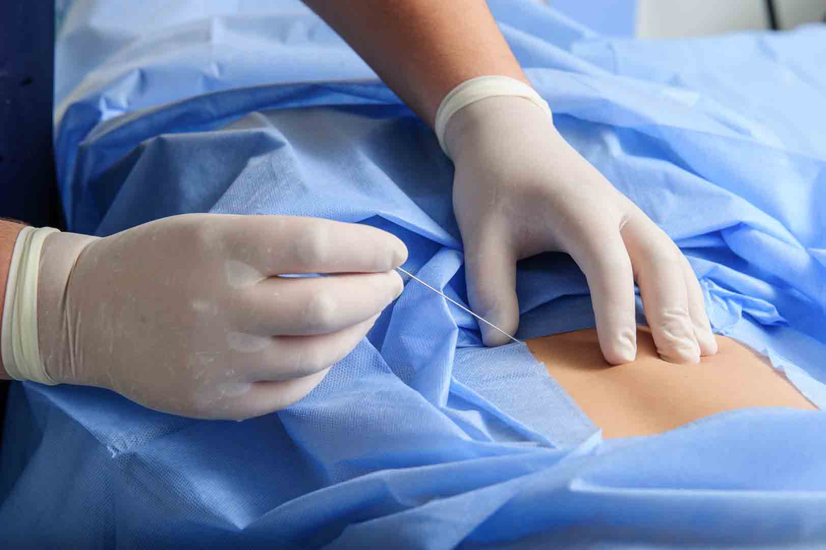 Image of a patient getting nerve pain relief treatments