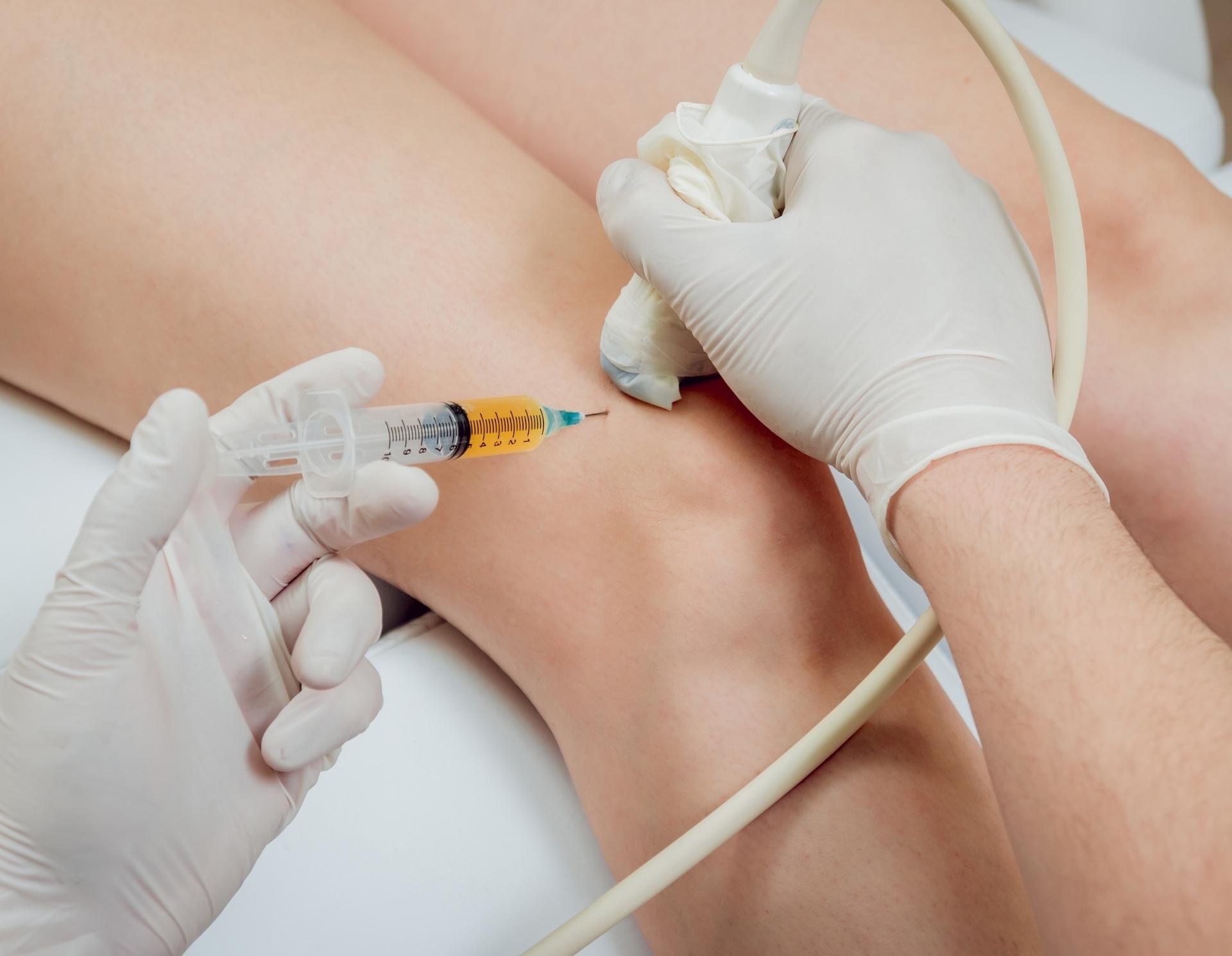 Image of a doctor performing radiofrequency lesioning on someone with knee pain