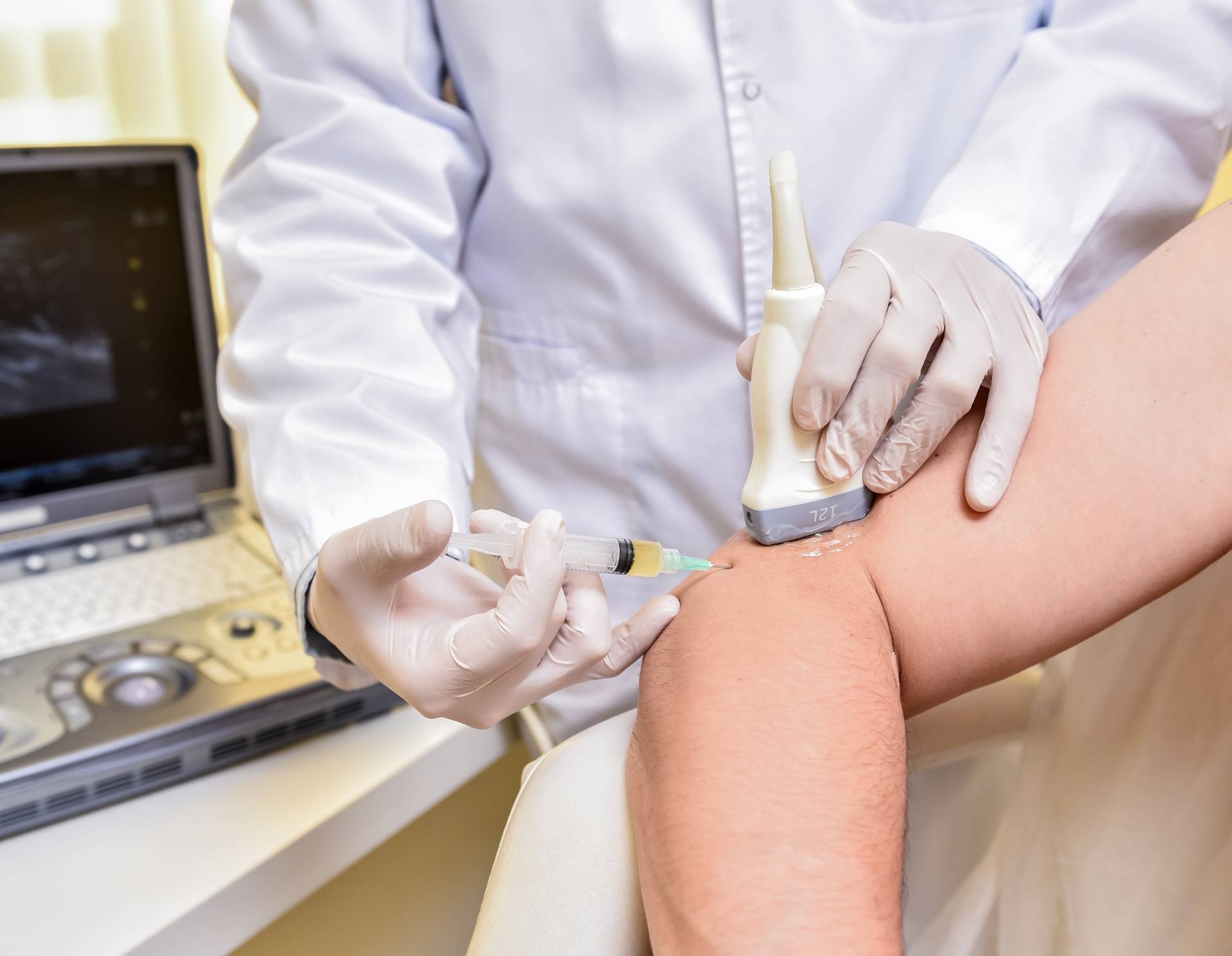 Image of a doctor performing radiofrequency lesioning on someone with knee pain